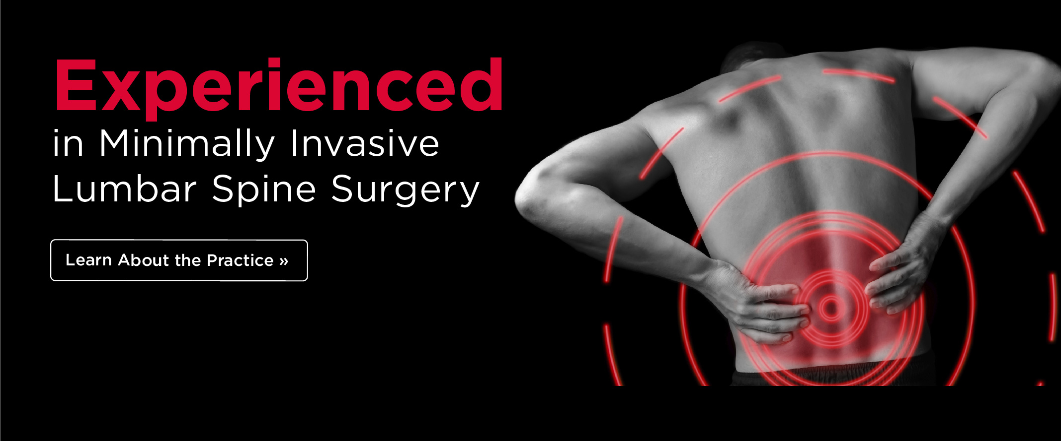 Dr. Paul Crowe Experience in Minimally Invasive Lumbar Spine Surgery